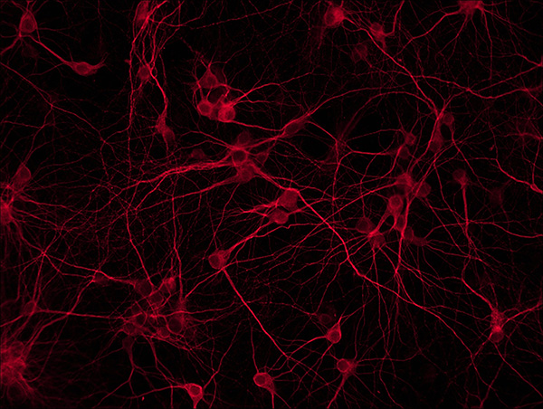 MV20-N 顯微鏡攝像頭 攝像頭